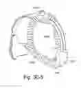 Fig. 85 - Delivery of respiratory therapy
