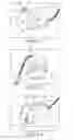 Fig. 02 - Mask system comprising a combined air delivery and stabilizing structure