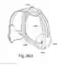 Fig. 85 - Mask system comprising a combined air delivery and stabilizing structure