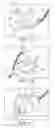 Fig. 02 - Delivery of respiratory therapy using collapsible inlet conduits