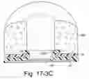 Fig. 49 - Delivery of respiratory therapy using collapsible inlet conduits