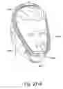 Fig. 69 - Delivery of respiratory therapy using collapsible inlet conduits