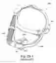 Fig. 76 - Delivery of respiratory therapy using collapsible inlet conduits