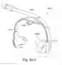 Fig. 83 - Delivery of respiratory therapy using collapsible inlet conduits
