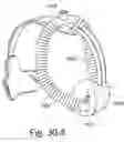 Fig. 85 - Delivery of respiratory therapy using collapsible inlet conduits
