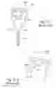 Fig. 86 - Delivery of respiratory therapy using collapsible inlet conduits