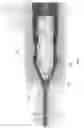 Fig. 02 - Needle safety clip, systems and methods