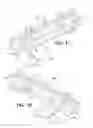 Fig. 03 - Apparatus For A Side-Loading Guidewire Torque Device