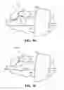 Fig. 16 - Apparatus For A Side-Loading Guidewire Torque Device