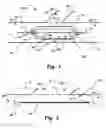 Fig. 02 - Medical device, method and system for temporary occlusion of an opening in a lumen of a body