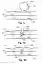 Fig. 06 - Medical device, method and system for temporary occlusion of an opening in a lumen of a body
