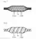 Fig. 06 - Balloon catheter