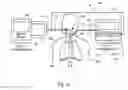 Fig. 02 - Percutaneous electrical phrenic nerve stimulation system