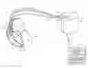 Fig. 01 - Implantable medical device and method for determining His bundle pacing capture