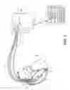 Fig. 02 - Implantable medical device and method for determining His bundle pacing capture