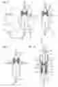 Fig. 07 - PROCESS AND APPARATUS FOR PRODUCING A PRODUCT GAS STREAM