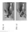 Fig. 08 - Reagent Storage Device for Storing a Target-Specific Reagent