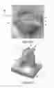 Fig. 07 - Retaining device including reinforced retaining elements