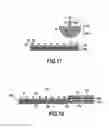 Fig. 11 - Retaining device including reinforced retaining elements