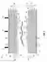 Fig. 04 - System for adjusting the equilibrium temperature of an inductively-heated susceptor