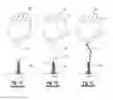 Fig. 02 - Lightning protection device for an aircraft, aircraft comprising such a lightning protection device