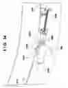 Fig. 35 - Coupling/uncoupling device