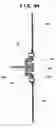 Fig. 83 - Coupling/uncoupling device