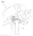 Fig. 06 - Conveying device