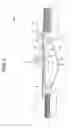 Fig. 02 - RECORDING MEDIUM CONVEYANCE DEVICE AND INKJET RECORDING DEVICE