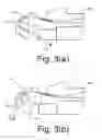 Fig. 04 - Media diversion apparatus