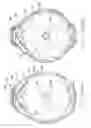 Fig. 19 - Reduced sized wearable retractable