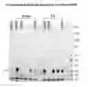 Fig. 01 - Modulation of N-acylethanolamine-hydrolysing acid amidase (NAAA) for disease treatment
