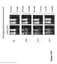 Fig. 65 - COMPOUND CHIMERIC ANTIGEN RECEPTOR (cCAR) TARGETING MULTIPLE ANTIGENS, COMPOSITIONS AND METHODS OF USE THEREOF