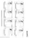Fig. 75 - COMPOUND CHIMERIC ANTIGEN RECEPTOR (cCAR) TARGETING MULTIPLE ANTIGENS, COMPOSITIONS AND METHODS OF USE THEREOF