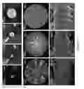 Fig. 22 - Crystal Structures Comprising Elastin-Like Peptides