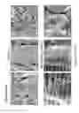 Fig. 44 - Crystal Structures Comprising Elastin-Like Peptides