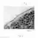 Fig. 09 - LAYERED PRODUCT