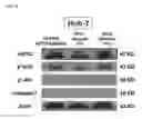 Fig. 17 - Glypican-3 specific aptamer and use thereof