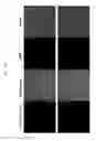 Fig. 23 - Glypican-3 specific aptamer and use thereof