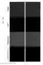 Fig. 25 - Glypican-3 specific aptamer and use thereof