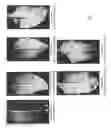 Fig. 22 - PROCESS FOR TRANSFECTING PLANTS