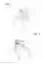 Fig. 07 - ARRANGEMENT INTRODUCED IN A DEVICE HAVING A HOOK FOR ANCHORING A LADDER TO CABLES
