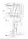 Fig. 04 - Arm for turbine-engine casing comprising a removable additional piece