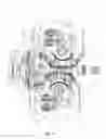 Fig. 07 - Variable valve timing system for an engine