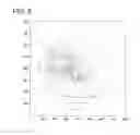 Fig. 07 - Unevenness evaluation method and unevenness evaluation apparatus