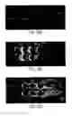 Fig. 32 - Devices and methods for contactless dielectrophoresis for cell or particle manipulation