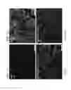 Fig. 04 - HIGH THROUGHPUT SCREENING OF AGENTS ON DOPAMINERGIC NEURONS