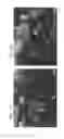 Fig. 06 - HIGH THROUGHPUT SCREENING OF AGENTS ON DOPAMINERGIC NEURONS