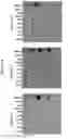 Fig. 02 - METHODS AND KITS FOR DIAGNOSING AND TREATING NERVOUS SYSTEM DISEASE OR INJURY