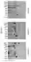 Fig. 03 - METHODS AND KITS FOR DIAGNOSING AND TREATING NERVOUS SYSTEM DISEASE OR INJURY